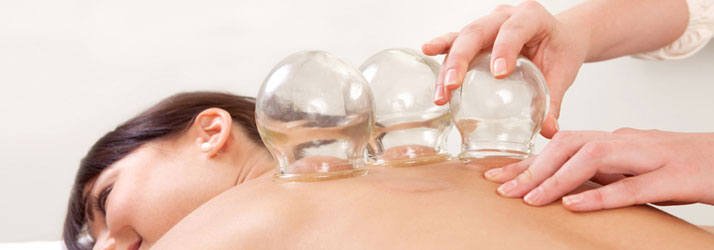 Chiropractic Evanston IL Cupping