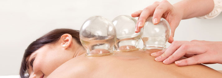 Chiropractic Evanston IL Cupping Chiropractic Evanston IL Cupping