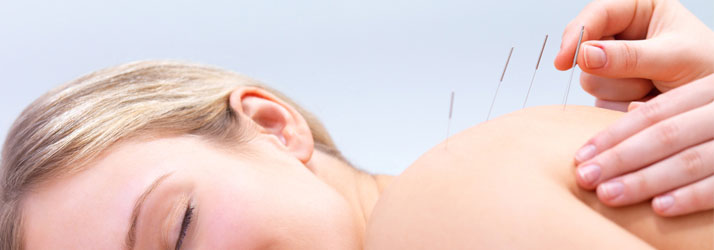 Chiropractic Evanston IL Dry Needling Chiropractic Evanston IL Dry Needling